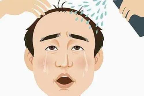 植發(fā) 植發(fā)